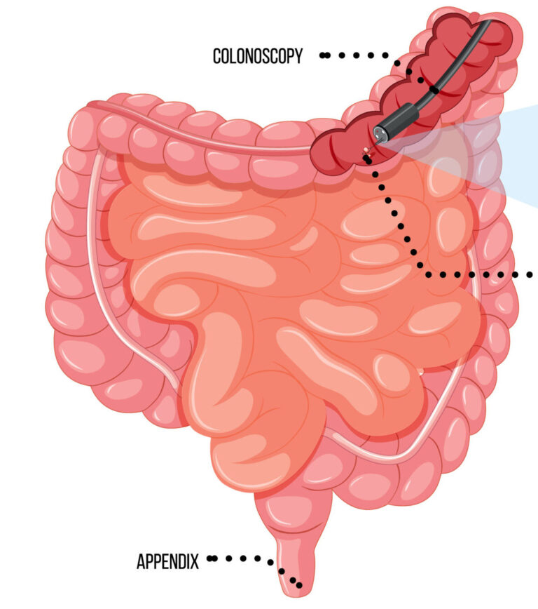 Endoscopy